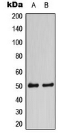 CaMKII Alpha+Delta Antibody - Western blot analysis of CaMK2 alpha/delta expression in HEK293A (A); NIH3T3 (B) whole cell lysates.