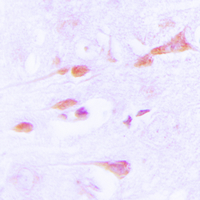 CaMKII Alpha+Delta Antibody - Immunohistochemical analysis of CaMK2 alpha/delta staining in human brain formalin fixed paraffin embedded tissue section. The section was pre-treated using heat mediated antigen retrieval with sodium citrate buffer (pH 6.0). The section was then incubated with the antibody at room temperature and detected using an HRP conjugated compact polymer system. DAB was used as the chromogen. The section was then counterstained with hematoxylin and mounted with DPX.