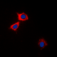 CaMKII Alpha+Delta Antibody - Immunofluorescent analysis of CaMK2 alpha/delta staining in HEK293A cells. Formalin-fixed cells were permeabilized with 0.1% Triton X-100 in TBS for 5-10 minutes and blocked with 3% BSA-PBS for 30 minutes at room temperature. Cells were probed with the primary antibody in 3% BSA-PBS and incubated overnight at 4 C in a humidified chamber. Cells were washed with PBST and incubated with a DyLight 594-conjugated secondary antibody (red) in PBS at room temperature in the dark. DAPI was used to stain the cell nuclei (blue).