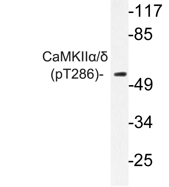 CaMKII Alpha+Delta Antibody - Western blot of p-CaMKII/ (T286) pAb in extracts from K562 cells.