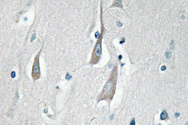 CaMKII Alpha+Delta Antibody - IHC of p-CaMKII/ (T286) pAb in paraffin-embedded human brain tissue.