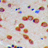 CaMKII Alpha+Delta Antibody - Immunohistochemical analysis of CaMK2 alpha/delta (pT286) staining in human brain formalin fixed paraffin embedded tissue section. The section was pre-treated using heat mediated antigen retrieval with sodium citrate buffer (pH 6.0). The section was then incubated with the antibody at room temperature and detected using an HRP conjugated compact polymer system. DAB was used as the chromogen. The section was then counterstained with hematoxylin and mounted with DPX. w