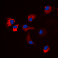 CaMKII Alpha+Delta Antibody - Immunofluorescent analysis of CaMK2 alpha/delta (pT286) staining in HeLa cells. Formalin-fixed cells were permeabilized with 0.1% Triton X-100 in TBS for 5-10 minutes and blocked with 3% BSA-PBS for 30 minutes at room temperature. Cells were probed with the primary antibody in 3% BSA-PBS and incubated overnight at 4 C in a humidified chamber. Cells were washed with PBST and incubated with a DyLight 594-conjugated secondary antibody (red) in PBS at room temperature in the dark. DAPI was used to stain the cell nuclei (blue).