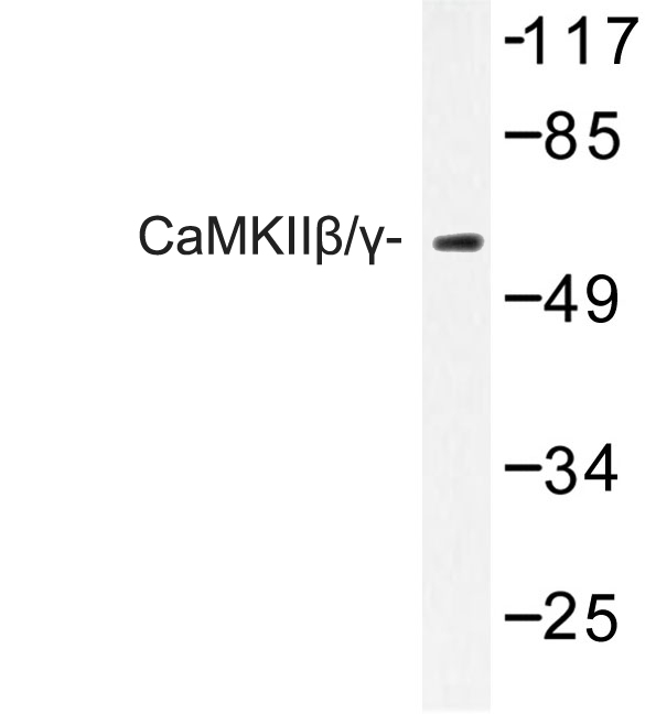 CaMKII Beta+Gamma Antibody - Western blot of CaMKII/ (R631) pAb in extracts from COLO205 cells.