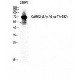 CaMKII Beta+Gamma+Delta Antibody - Western blot of Phospho-CaMKII beta/gamma/delta (T287) antibody