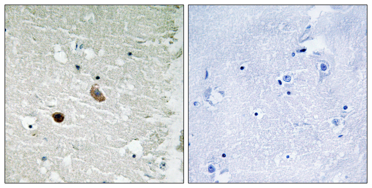 CaMKII Beta+Gamma+Delta Antibody - Immunohistochemistry analysis of paraffin-embedded human brain tissue, using CaMK2-beta/gamma/delta Antibody. The picture on the right is blocked with the synthesized peptide.