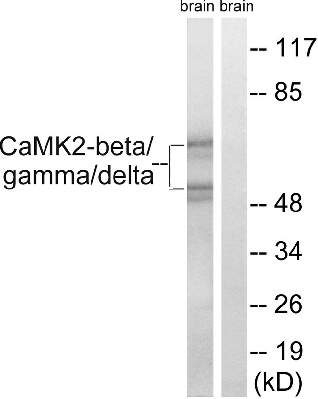 CaMKII Beta+Gamma+Delta Antibody - Western blot analysis of lysates from rat brain cells, using CaMK2-beta/gamma/delta Antibody. The lane on the right is blocked with the synthesized peptide.