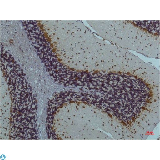 CaMKII Beta+Gamma+Delta Antibody - Immunohistochemistry (IHC) analysis of paraffin-embedded Rat Brain Tissue using CaMKIIbeta/ gamma /delta (Phospho Thr287) (Monoclonal Antibody diluted at 1:200.