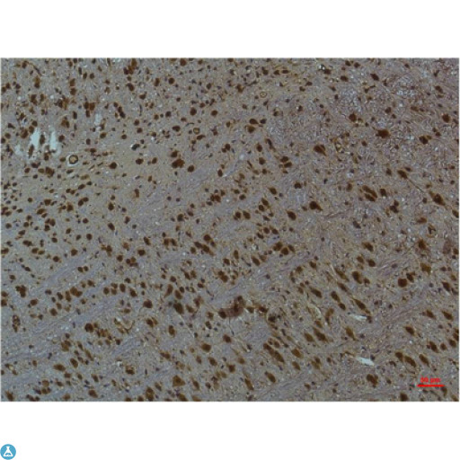 CaMKII Beta+Gamma+Delta Antibody - Immunohistochemistry (IHC) analysis of paraffin-embedded Mouse Brain Tissue using CaMKIIbeta/ gamma /delta (Phospho Thr287) Mouse Monoclonal Antibody diluted at 1:200.