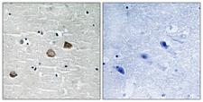 CaMKII Beta+Gamma+Delta Antibody - Immunohistochemistry analysis of paraffin-embedded human brain, using CaMK2-beta/gamma/delta (Phospho-Thr287) Antibody. The picture on the right is blocked with the phospho peptide.