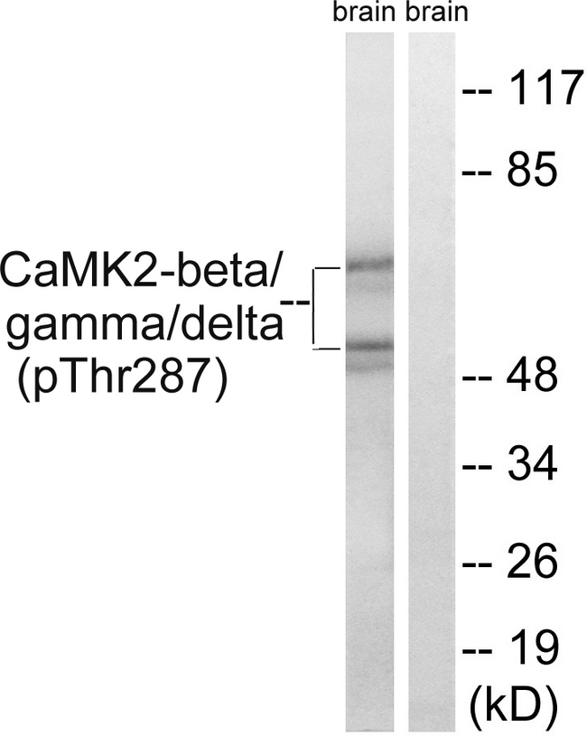CaMKII Beta+Gamma+Delta Antibody - Western blot analysis of lysates from rat brain, using CaMK2-beta/gamma/delta (Phospho-Thr287) Antibody. The lane on the right is blocked with the phospho peptide.