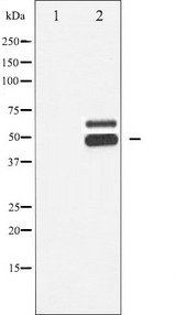 CaMKII Beta+Gamma+Delta Antibody - Western blot analysis of CaMK2-beta/gamma/delta phosphorylation expression in rat brain tissue lysates. The lane on the left is treated with the antigen-specific peptide.