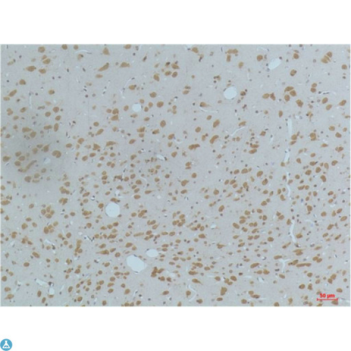 CaMKII Beta+Gamma+Delta Antibody - Immunohistochemistry (IHC) analysis of paraffin-embedded Rat Brain Tissue using CaMKIIbeta/ gamma /delta (Phospho Thr287) (Monoclonal Antibody diluted at 1:200.