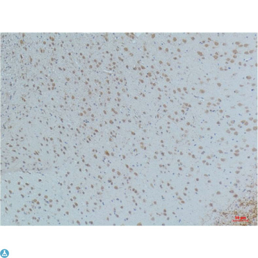 CaMKII Beta+Gamma+Delta Antibody - Immunohistochemistry (IHC) analysis of paraffin-embedded Mouse Brain Tissue using CaMKIIbeta/ gamma /delta (Phospho Thr287) Mouse Monoclonal Antibody diluted at 1:200.
