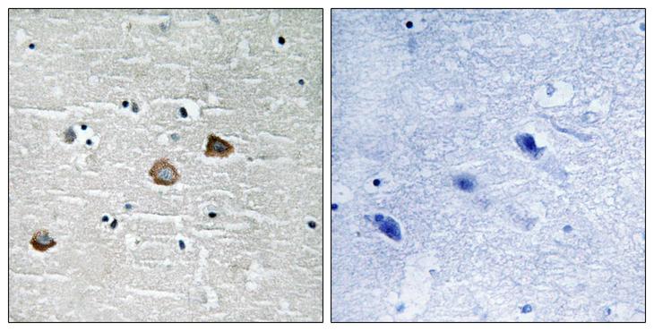 CaMKII Beta+Gamma+Delta Antibody - P-peptide - + Immunohistochemistry analysis of paraffin-embedded human brain tissue using CaMK2-ß/?/d (Phospho-Thr287) antibody.