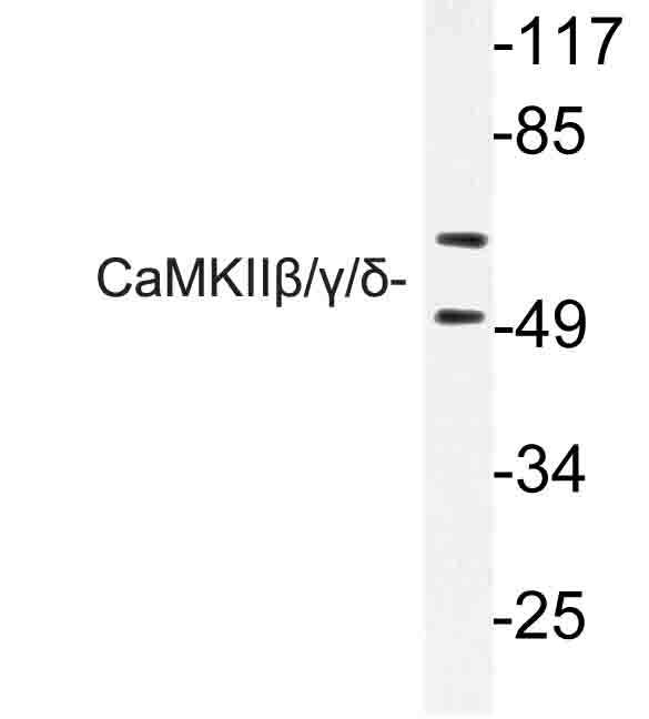 CaMKII Beta+Gamma+Delta Antibody - Western blot of CaMKII// (S280) pAb in extracts from rat brain cells.