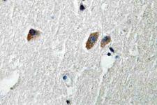 CaMKII Beta+Gamma+Delta Antibody - IHC of CaMKII// (S280) pAb in paraffin-embedded human brain tissue.