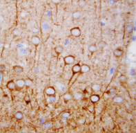 CAMKK1 Antibody - CAMKK1 / CaMKK antibody. IHC(P): Rat Brain Tissue.
