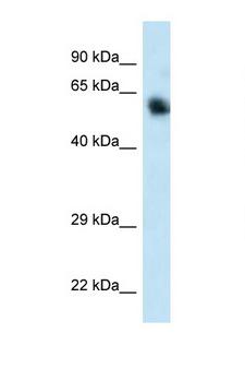 CAMKK1 Antibody - CAMKK1 / CaMKK antibody Western blot of 293T Cell lysate. Antibody concentration 1 ug/ml.  This image was taken for the unconjugated form of this product. Other forms have not been tested.