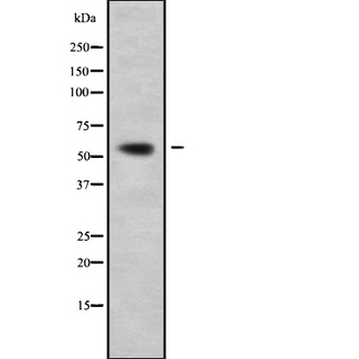 CAMKK1 Antibody - Western blot analysis of CAMKK1 using HuvEc whole cells lysates