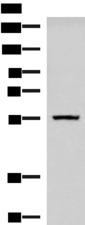 CAMKK1 Antibody - Western blot analysis of Human cerebella tissue lysate  using CAMKK1 Polyclonal Antibody at dilution of 1:700
