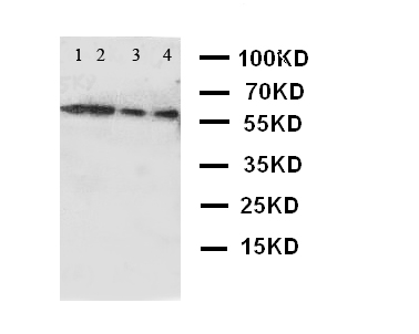 CAMKK2 Antibody - WB of CAMKK2 / CAMKK antibody. Lane 1: Rat Brain Tissue Lysate. Lane 2: Rat Brain Tissue Lysate. Lane 3: Mouse Brain Tissue Lysate. Lane 4: Mouse Brain Tissue Lysate.