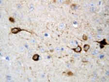 CAMKK2 Antibody - CAMKK2 / CAMKK antibody. IHC(P): Rat Brain Tissue.
