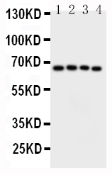 CAMKK2 Antibody - Anti-CAMKK2 antibody, Western blotting Lane 1: Rat Brain Tissue LysateLane 2: Rat Brain Tissue LysateLane 3: Mouse Brain Tissue LysateLane 4: Mouse Brain Tissue Lysate