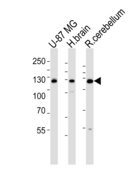 CAMKK2 Antibody - Western blot of lysates from U-87 MG cell line , human brain and rat cerebellum tissue lysate(from left to right), using Mouse Camkk2 Antibody. Antibody was diluted at 1:1000 at each lane. A goat anti-rabbit IgG H&L (HRP) at 1:5000 dilution was used as the secondary antibody. Lysates at 35ug per lane.