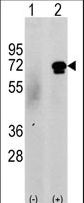 CAMKK2 Antibody - Western blot of CAMKK2 (arrow) using rabbit polyclonal CAMKK2 Antibody (N-term G67). 293 cell lysates (2 ug/lane) either nontransfected (c) or transiently transfected with the CAMKK2 gene (Lane 2) (Origene Technologies).