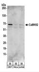 CAMKK2 Antibody - Detection of Human CaMKK2 by Western Blot. Samples: Whole cell lysate (50 ug) from 293T, HeLa, and Jurkat cells. Antibodies: Affinity purified rabbit anti-CaMKK2 antibody used for WB at 1 ug/ml. Detection: Chemiluminescence with an exposure time of 30 seconds.