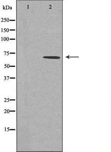 CAMKK2 Antibody - Western blot analysis of extracts of HuvEc cells using CAMKK2 antibody. The lane on the left is treated with the antigen-specific peptide.
