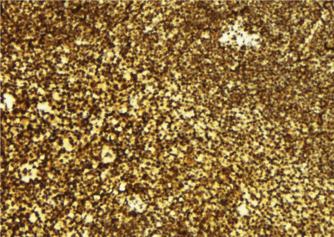 CAMKK2 Antibody - 1:100 staining mouse spleen tissue by IHC-P. The sample was formaldehyde fixed and a heat mediated antigen retrieval step in citrate buffer was performed. The sample was then blocked and incubated with the antibody for 1.5 hours at 22°C. An HRP conjugated goat anti-rabbit antibody was used as the secondary.