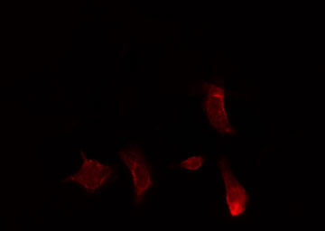 CAMKK2 Antibody - Staining HuvEc cells by IF/ICC. The samples were fixed with PFA and permeabilized in 0.1% Triton X-100, then blocked in 10% serum for 45 min at 25°C. The primary antibody was diluted at 1:200 and incubated with the sample for 1 hour at 37°C. An Alexa Fluor 594 conjugated goat anti-rabbit IgG (H+L) antibody, diluted at 1/600, was used as secondary antibody.