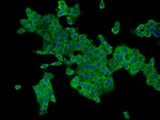 CAMKK2 Antibody - Immunofluorescence staining of CAMKK2 in A431 cells. Cells were fixed with 4% PFA, permeabilzed with 0.1% Triton X-100 in PBS, blocked with 10% serum, and incubated with rabbit anti-Human CAMKK2 polyclonal antibody (dilution ratio 1:200) at 4°C overnight. Then cells were stained with the Alexa Fluor 488-conjugated Goat Anti-rabbit IgG secondary antibody (green) and counterstained with DAPI (blue). Positive staining was localized to Cytoplasm.