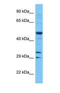 CAMKV Antibody - Western blot of CAMKV Antibody with human RPMI-8226 Whole Cell lysate.  This image was taken for the unconjugated form of this product. Other forms have not been tested.