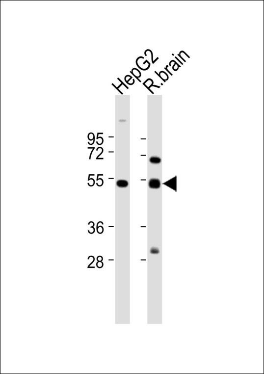 CAMKV Antibody - All lanes : Anti-CAMKV Antibody at 1:1000 dilution Lane 1: HepG2 whole cell lysates Lane 2: R.brain tissue lysates Lysates/proteins at 20 ug per lane. Secondary Goat Anti-Rabbit IgG, (H+L),Peroxidase conjugated at 1/10000 dilution Predicted band size : 54 kDa Blocking/Dilution buffer: 5% NFDM/TBST.