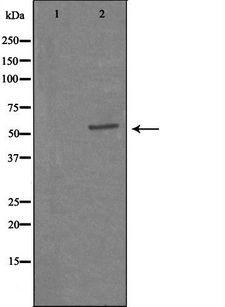 CAMKV Antibody - Western blot analysis of extracts of HepG2 cells using CAMK5 antibody. The lane on the left is treated with the antigen-specific peptide.