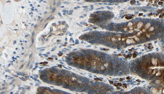 CAMKV Antibody - 1:100 staining mouse intestine tissue by IHC-P. The sample was formaldehyde fixed and a heat mediated antigen retrieval step in citrate buffer was performed. The sample was then blocked and incubated with the antibody for 1.5 hours at 22°C. An HRP conjugated goat anti-rabbit antibody was used as the secondary.
