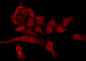 CAMKV Antibody - Staining HepG2 cells by IF/ICC. The samples were fixed with PFA and permeabilized in 0.1% Triton X-100, then blocked in 10% serum for 45 min at 25°C. The primary antibody was diluted at 1:200 and incubated with the sample for 1 hour at 37°C. An Alexa Fluor 594 conjugated goat anti-rabbit IgG (H+L) Ab, diluted at 1/600, was used as the secondary antibody.