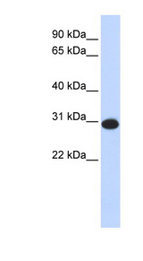 CAMLG / CAML Antibody - CAMLG antibody Western blot of Fetal Liver lysate. This image was taken for the unconjugated form of this product. Other forms have not been tested.