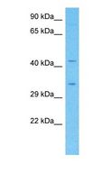 CAMLG / CAML Antibody - Western blot of CAMLG Antibody with human Fetal Liver lysate.  This image was taken for the unconjugated form of this product. Other forms have not been tested.