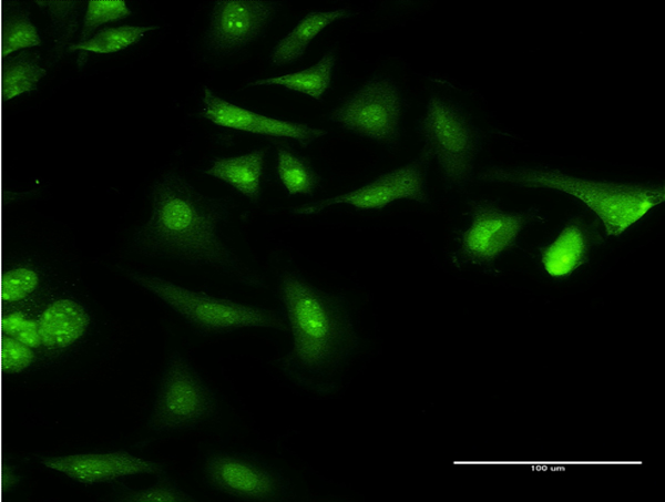 CAMLG / CAML Antibody - Immunofluorescence of monoclonal antibody to CAMLG on HeLa cell . [antibody concentration 10 ug/ml]