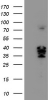 CAMLG / CAML Antibody - HEK293T cells were transfected with the pCMV6-ENTRY control (Left lane) or pCMV6-ENTRY CAMLG (Right lane) cDNA for 48 hrs and lysed. Equivalent amounts of cell lysates (5 ug per lane) were separated by SDS-PAGE and immunoblotted with anti-CAMLG.