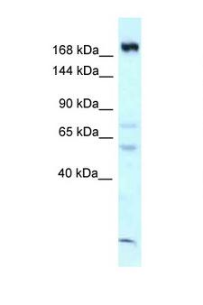CAMSAP1 Antibody - CAMSAP1 antibody Western blot of Mouse Thymus lysate. Antibody concentration 1 ug/ml.  This image was taken for the unconjugated form of this product. Other forms have not been tested.