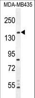 CAMSAP1 Antibody - CAMSAP1 Antibody western blot of MDA-MB435 cell line lysates (35 ug/lane). The CAMSAP1 antibody detected the CAMSAP1 protein (arrow).