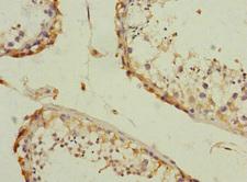 CAMSAP2 Antibody - Immunohistochemistry of paraffin-embedded human testis tissue at dilution 1:100