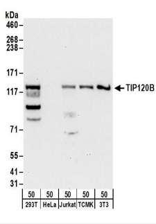 CAND2 / TIP120B Antibody - Detection of Human and Mouse TIP120B by Western Blot. Samples: Whole cell lysate (50 ug) from 293T, HeLa, Jurkat, mouse TCMK-1, and mouse NIH3T3 cells. Antibodies: Affinity purified rabbit anti-TIP120B antibody used for WB at 0.1 ug/ml. Detection: Chemiluminescence with an exposure time of 30 seconds.