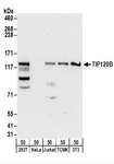 CAND2 / TIP120B Antibody - Detection of Human and Mouse TIP120B by Western Blot. Samples: Whole cell lysate (50 ug) from 293T, HeLa, Jurkat, mouse TCMK-1, and mouse NIH3T3 cells. Antibodies: Affinity purified rabbit anti-TIP120B antibody used for WB at 0.1 ug/ml. Detection: Chemiluminescence with an exposure time of 30 seconds.