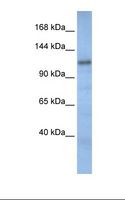 CAND2 / TIP120B Antibody - Fetal muscle lysate. Antibody concentration: 1.0 ug/ml. Gel concentration: 6-18%.  This image was taken for the unconjugated form of this product. Other forms have not been tested.